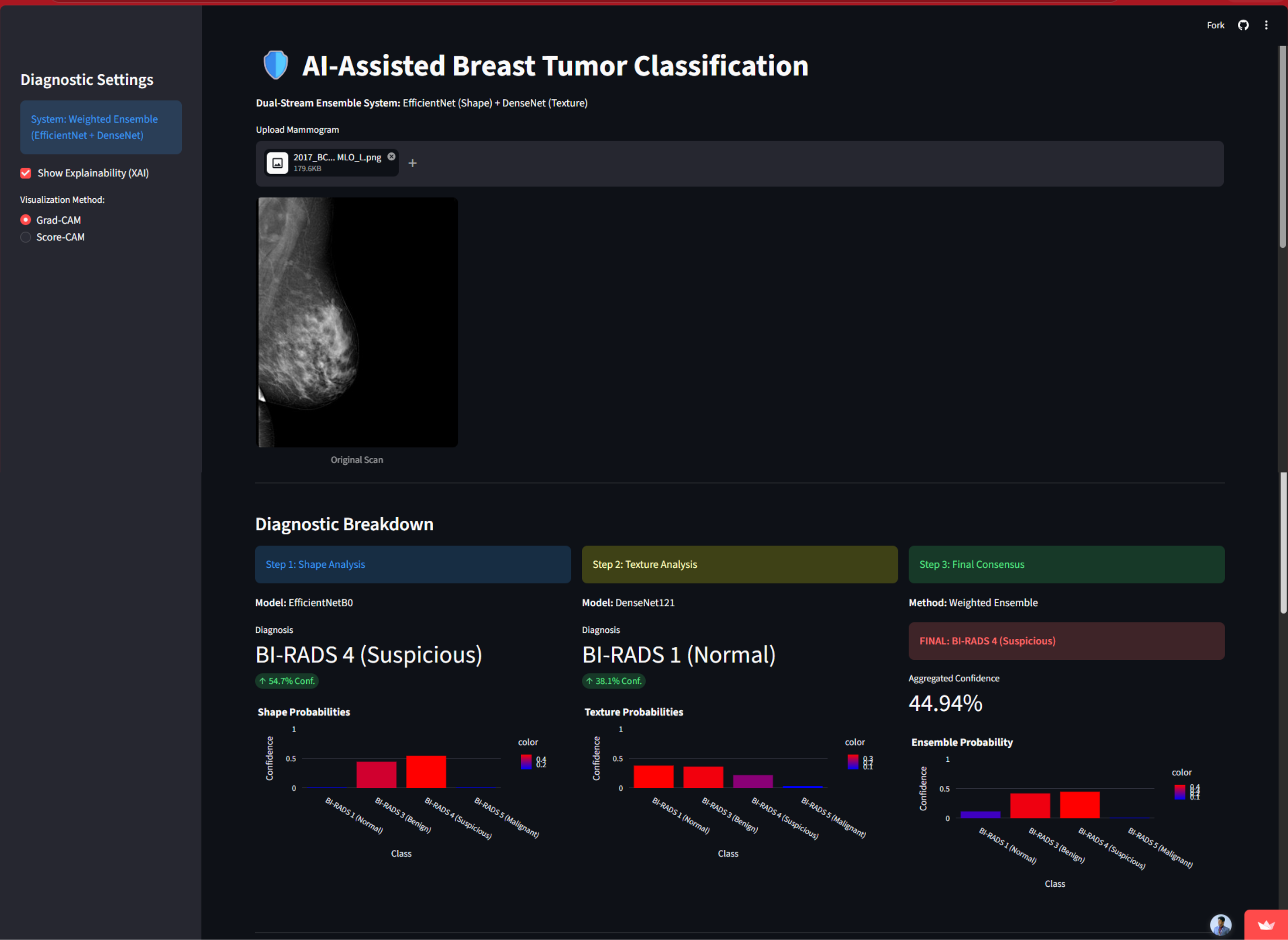 AI Assisted Breast Tumor Classification